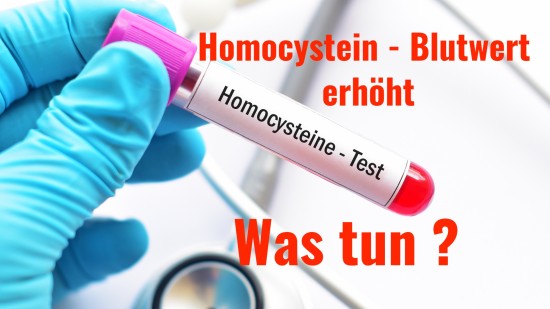 V-0270 Homocystein